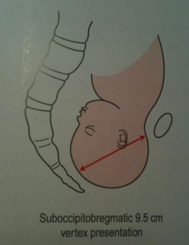 TEST 2 Intrapartum Labor And Birth Flashcards Quizlet