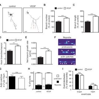 Working Model For Vegf Vegfr Function In Hippocampal Axon Branching