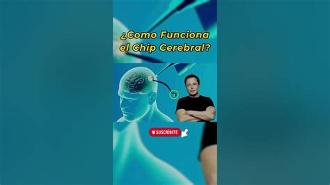 ¿como Funciona El Chip Cerebral Que Anunció Elon Musk El Primer Implante En Cerebro Humano