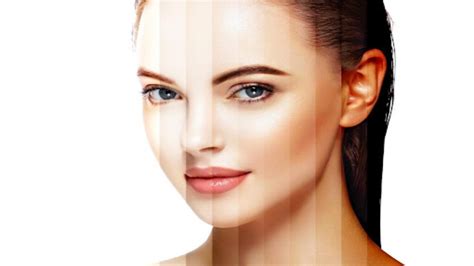 Uneven Skin Tone on Face - Causes & Removal Tips