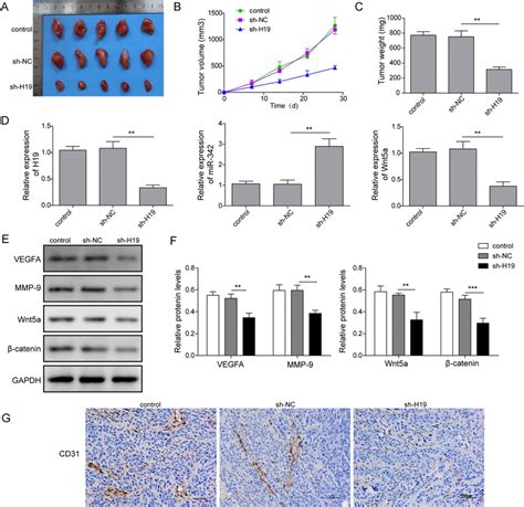 H19 Knockdown Suppressed Glioma Growth And Angiogenesis In Vivo The