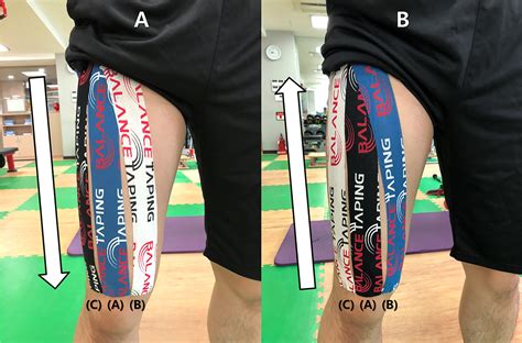 Effects Of The Direction Of Kinesiology Tape Application On The Delayed