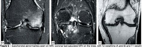 Figure 5 from MRI EVALUATION OF KNEE CARTILAGE | Semantic Scholar