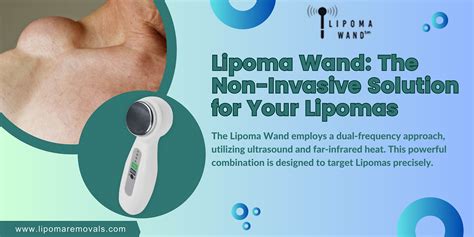 Exploring The Latest Breakthroughs In New Lipoma Treatment By Lipoma