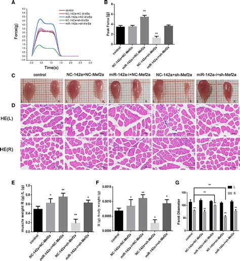 Microrna A P Regulates Neurogenic Skeletal Muscle Atrophy By