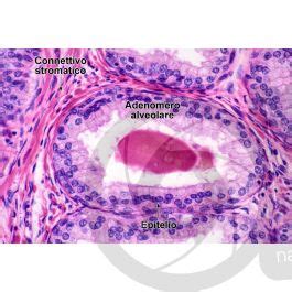 Uomo Prostata Sezione Trasversale X Uomo Mammiferi Apparato