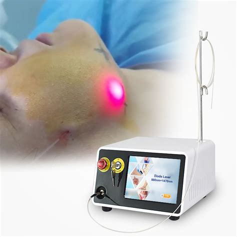 2024 New Sale 980 1470nm Laser Plastic Surgery Fiberlift Laser