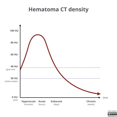 Hematocrit Chart A Visual Reference Of Charts Chart Master