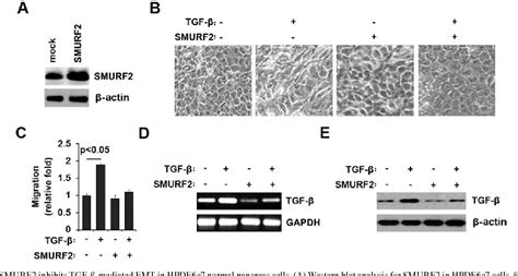 Figure 2 From Mir 15b Promotes Epithelial Mesenchymal Transition By