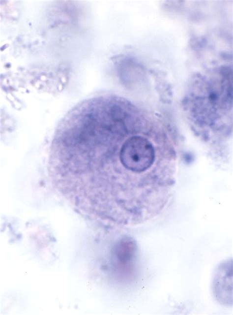 Entamoeba Histolytica Trophozoite And Cyst