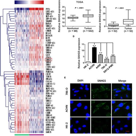 LINC00511 Is Upregulated In CcRCC Tissues And Cell Lines A RT QPCR