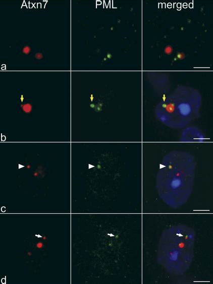 Atxn7 Aggregates Colocalize With Pml Bodies In Sca7 Transgenic Mice Download Scientific