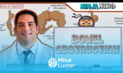 Learn Bowel Obstruction Clinical Medicine Mind Luster