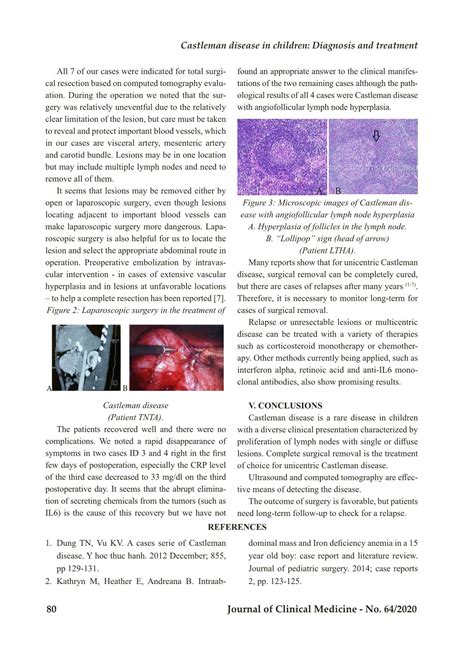 Castleman disease in children: Diagnosis and treatment