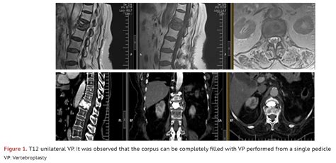 The Journal Of Turkish Spinal Surgery