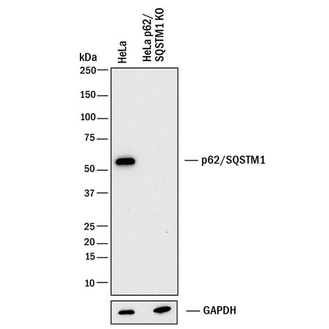 Human P62sqstm1 Antibody Mab80281 Bio Techne