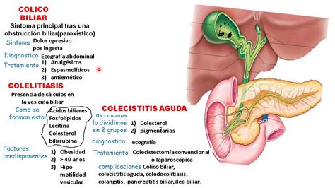 Coledocolitiasis Vs Colelitiasis