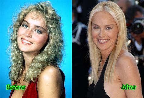 Sharon Stone Plastic Surgery Before and After - Plastic Surgery Mistakes