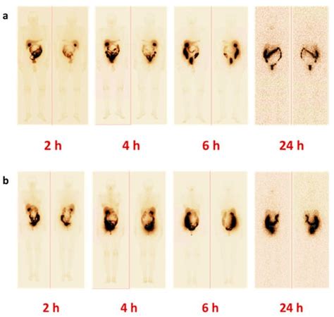 Cancers Free Full Text Phase I Trial Of 99mtc Tc Masss Peg2 Rm26