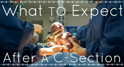 Life After C Section What To Expect After A C Section Daily Mom