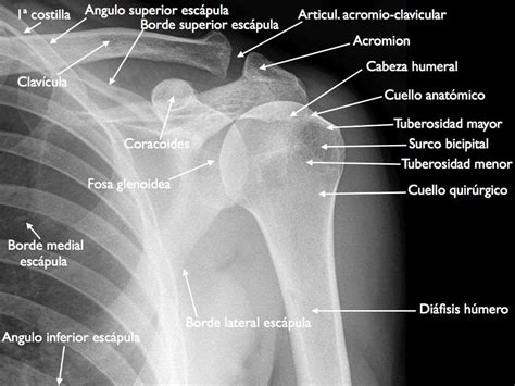 Hombro y clavícula Anatomía Radiología