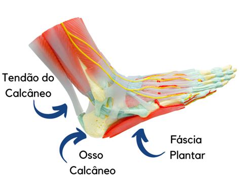 Dor No Calcanhar Saiba As Principais Causas Medicina Ortop Dica