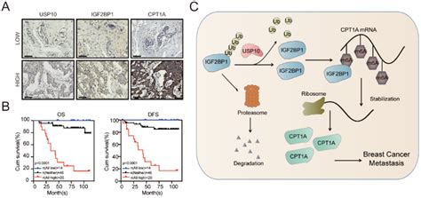 The Clinical Significance Of The Usp10igf2bp1cpt1a Axis In Bc