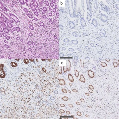 Hematoxylin Eosin And Immunohistochemical Staining Results High