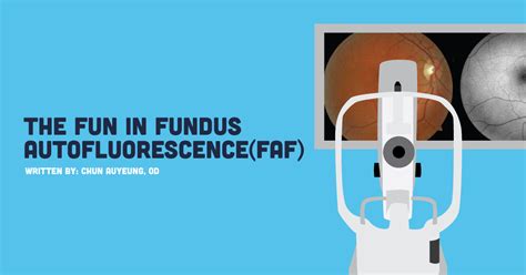 Putting The Fun In Fundus Autofluorescence FAF