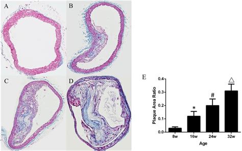 Masson Trichrome Stains Of The Ascending Aorta In Apoe Mice A