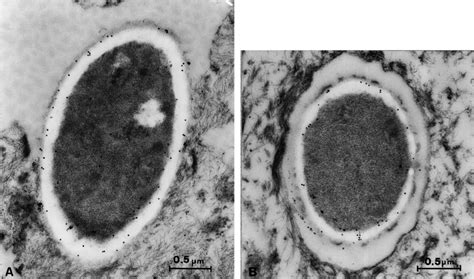 Electron Microscopy With Postembedding Immunogold Labeling By Use Of