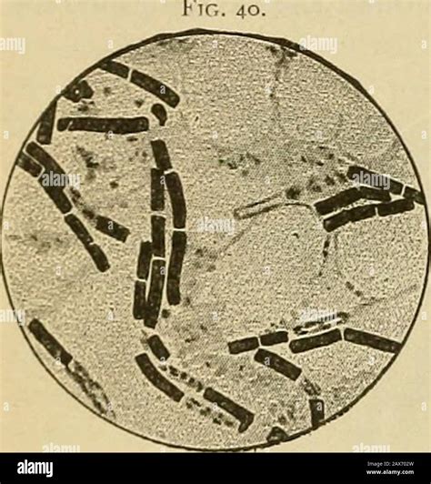 Actinomyces hi-res stock photography and images - Alamy