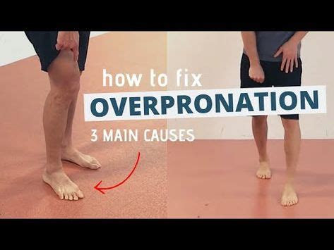 Overpronation exercises with Eric