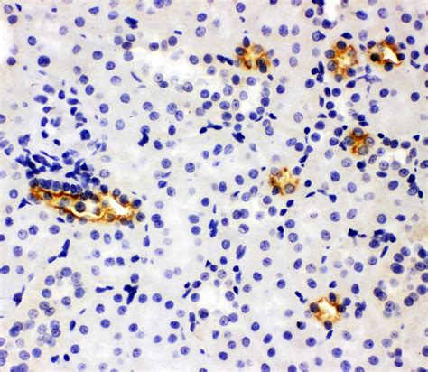 Anti Slc A Nkcc Antibody Rabbit Anti Human Polyclonal Ihc Wb Lsbio