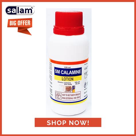 Sm Calamine Lotion 120ml Exp122024 Relief Itchinessmelegakan