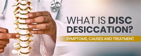 What Is Disc Desiccation? Symptoms, Causes and Treatment