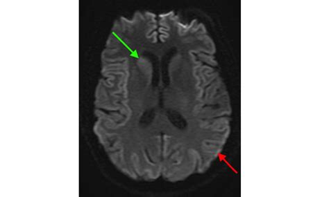 Brain Magnetic Resonance Imaging (MRI) | Pathology | School of Medicine ...