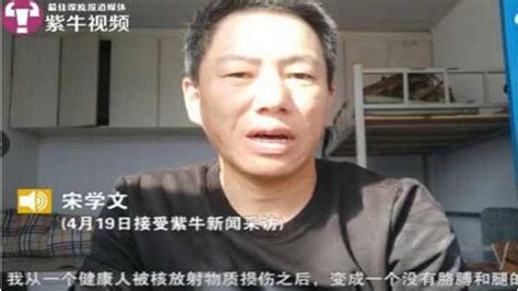 中国首例核辐射案受害者去世：截去双腿只剩肉段 Youtube