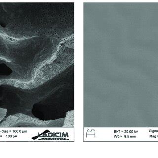 Sem Image Of Pvdf Pdms Hollow Fiber Membrane A Cross Section Detail