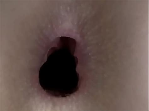 Anal Gape XVIDEOS