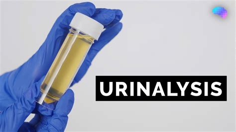 Urinalysis Urine Dipstick Test Osce Guide Ukmla Cpsa Plab 2