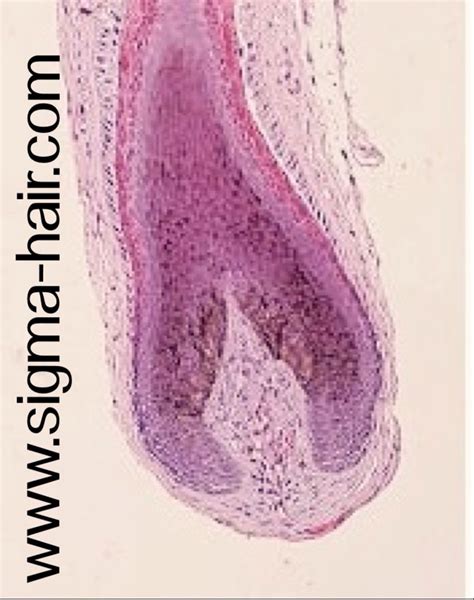 Bulbous of hair under microscope www.sigma-hair.com Hair Under ...