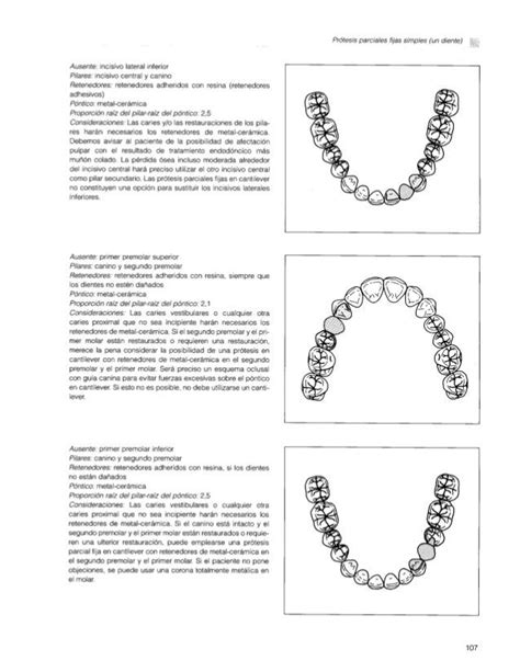 Fundamentos Esenciales En Protesis Fija Msd Chain Necklace Necklace