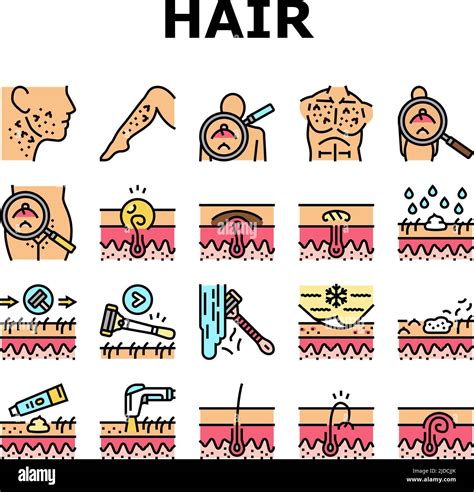 Ingrown Hair Problem Treatment Icons Set Vector Stock Vector Image