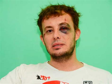 Joven gay denuncio discrimiación y golpes en un boliche de Santa Rosa