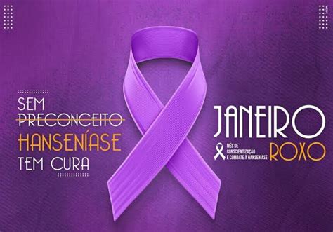 Janeiro Roxo Campanha Conscientiza Sobre A Hansen Ase Jornal O Imparcial