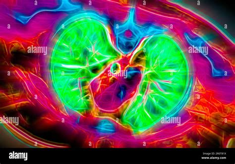 Healthy lungs, CT scan Stock Photo - Alamy