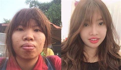 Loạt hot girl mạng xã hội nổi tiếng nhờ dao kéo trùng tu đổi mặt đổi luôn cả cuộc đời