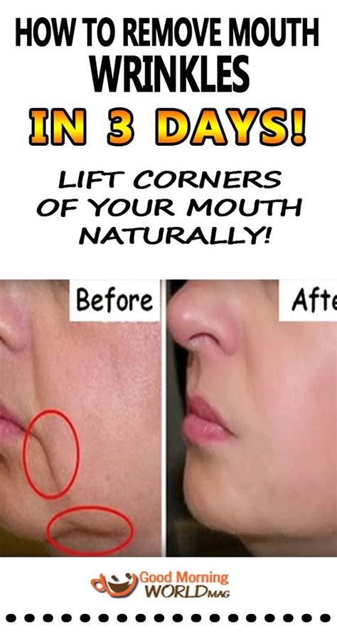 Facial Exercises For Drooping Mouth Corners – Online degrees