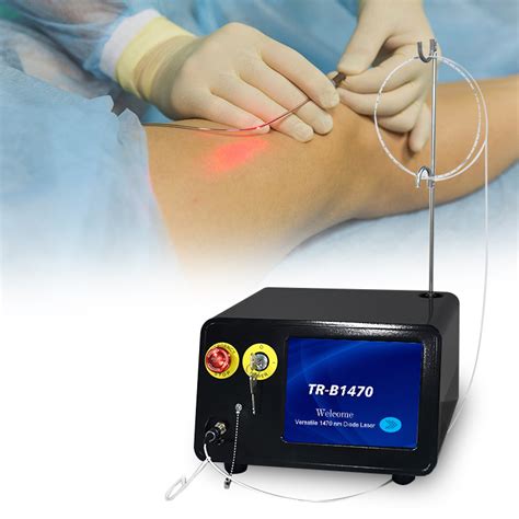 New Nm Evlt Varicose Vein Treatment Laser Price Nm Diode Laser